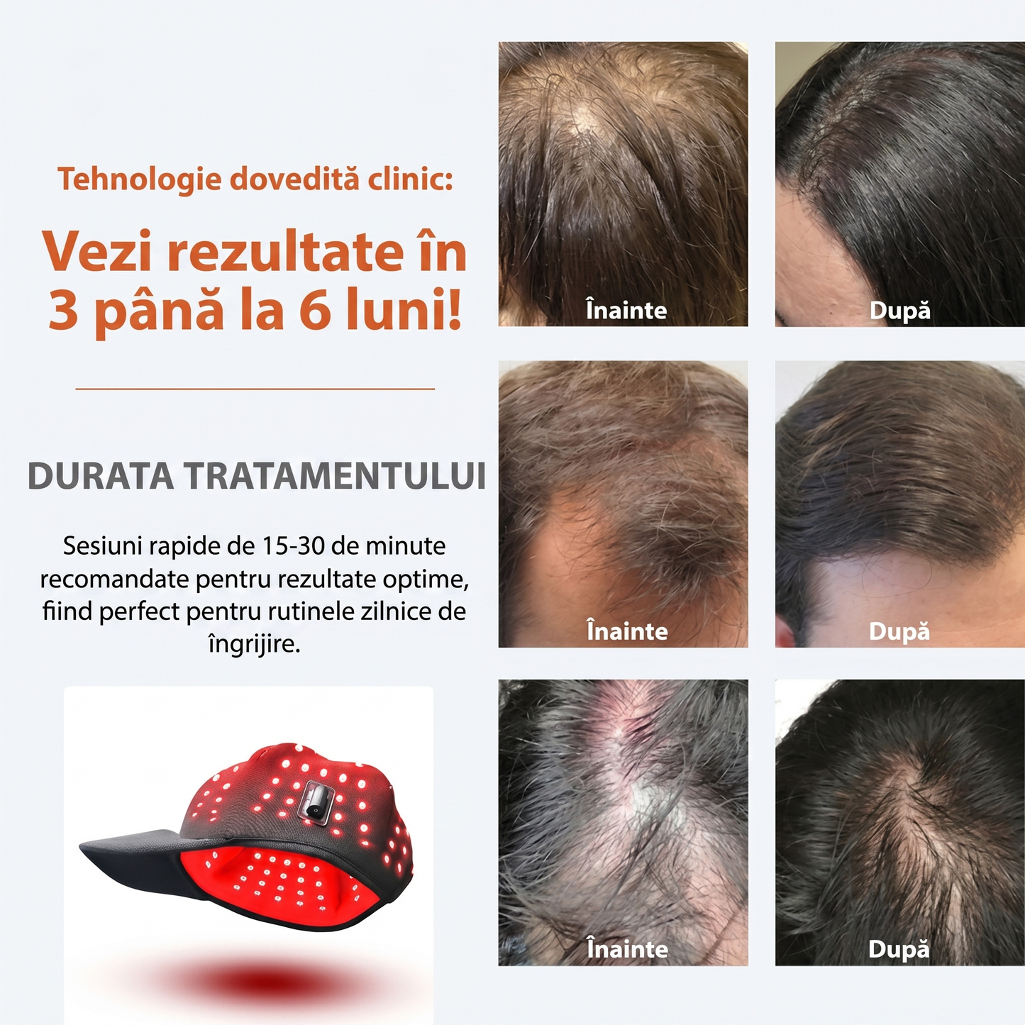 Șapcă Fototerapie pentru Regenerarea și Creșterea Părului