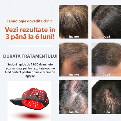 Șapcă Fototerapie pentru Regenerarea și Creșterea Părului