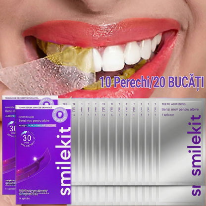 SmileKit - Benzi de Albire pentru Dinți