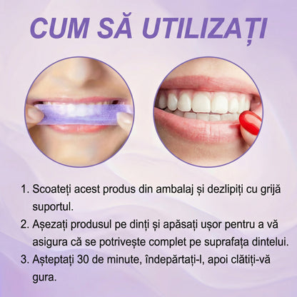 SmileKit - Benzi de Albire pentru Dinți