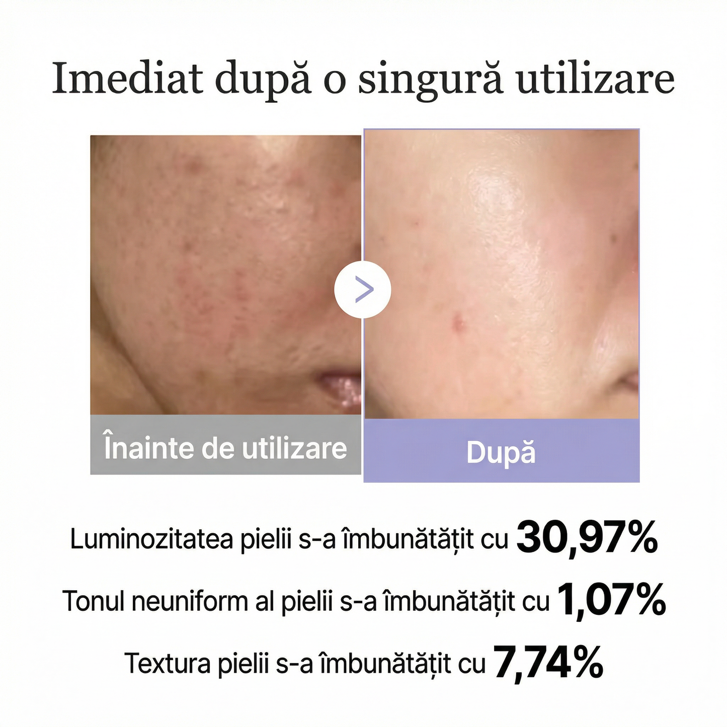 Dispozitiv Facial Anti-Îmbătrânire Portabil cu Încălzire, LED și Încărcare USB-C