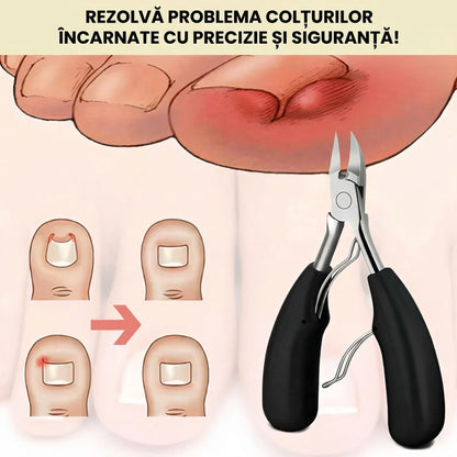 Trusă Pentru Unghii Groase Și Încarnate Cu Lame Ascuțite Din Oțel Chirurgical (5 Piese)